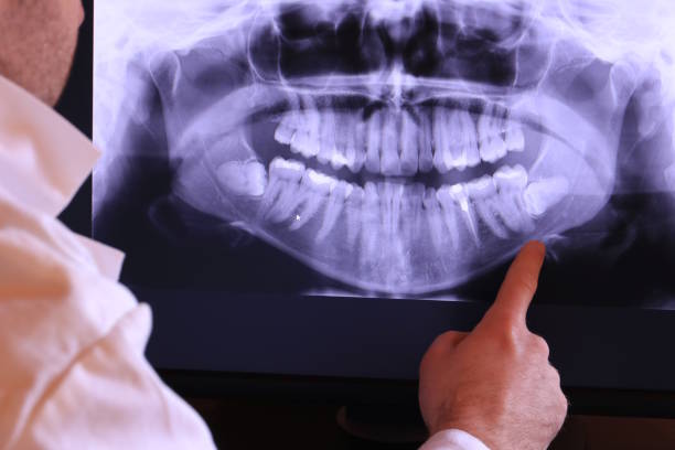 Best Knocked-Out Tooth Emergency  in August, CA