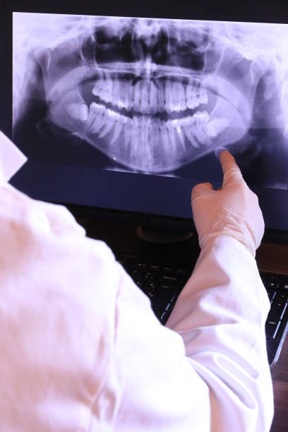 Best Chipped Tooth Repair Near Me  in August, CA